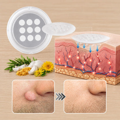 ✨✨✨PURESHADE® 2 az 1-ben mikrotűs és hidrokolloid tapasz🍀 | Kiálló anyajegyek, aknék, lapos szemölcsök és bőrnövedékek eltávolítására | Segít csökkenteni a ráncokat, hegeket és bőrhibákat | Láthatatlan tapasz az arcra és testre