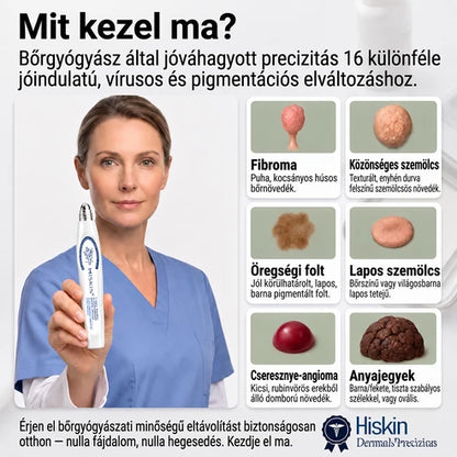 Hivatalos Márkabolt | 🚢🚢 Hiskin® 7 napos Szemölcseltávolító Roll-on Ápoló Folyadék (Fájdalommentes rollerball technológia, hegek nélkül) 🐬