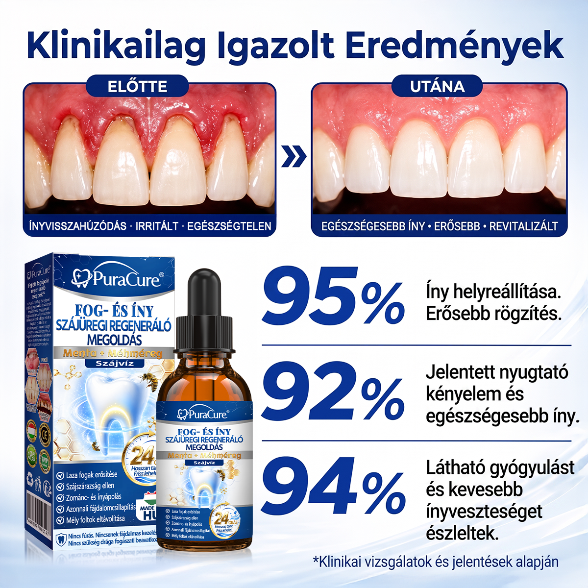 EZ AZ AJÁNLAT NEM VÁR ⏳ MOST −50% KEDVEZMÉNY 🔥 A KÉSZLET FOGY A VISSZASZÁMLÁLÁS MEGY AKI HABOZIK KÉSŐBB TÖBBET FIZET LÉPJ MOST