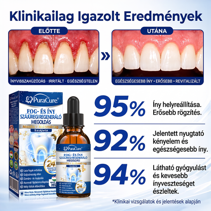 EZ AZ AJÁNLAT NEM VÁR ⏳ MOST −50% KEDVEZMÉNY 🔥 A KÉSZLET FOGY A VISSZASZÁMLÁLÁS MEGY AKI HABOZIK KÉSŐBB TÖBBET FIZET LÉPJ MOST