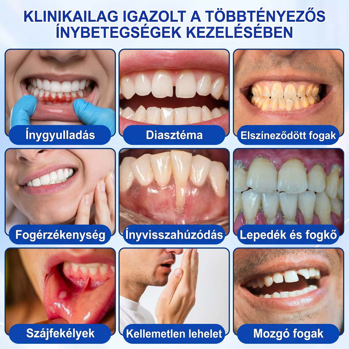 EZ AZ AJÁNLAT NEM VÁR ⏳ MOST −50% KEDVEZMÉNY 🔥 A KÉSZLET FOGY A VISSZASZÁMLÁLÁS MEGY AKI HABOZIK KÉSŐBB TÖBBET FIZET LÉPJ MOST