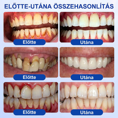 EZ AZ AJÁNLAT NEM VÁR ⏳ MOST −50% KEDVEZMÉNY 🔥 A KÉSZLET FOGY A VISSZASZÁMLÁLÁS MEGY AKI HABOZIK KÉSŐBB TÖBBET FIZET LÉPJ MOST