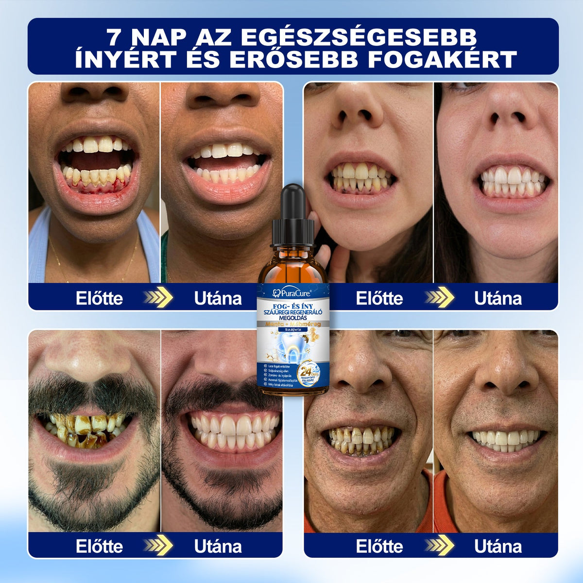 EZ AZ AJÁNLAT NEM VÁR ⏳ MOST −50% KEDVEZMÉNY 🔥 A KÉSZLET FOGY A VISSZASZÁMLÁLÁS MEGY AKI HABOZIK KÉSŐBB TÖBBET FIZET LÉPJ MOST