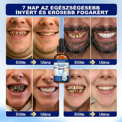 EZ AZ AJÁNLAT NEM VÁR ⏳ MOST −50% KEDVEZMÉNY 🔥 A KÉSZLET FOGY A VISSZASZÁMLÁLÁS MEGY AKI HABOZIK KÉSŐBB TÖBBET FIZET LÉPJ MOST