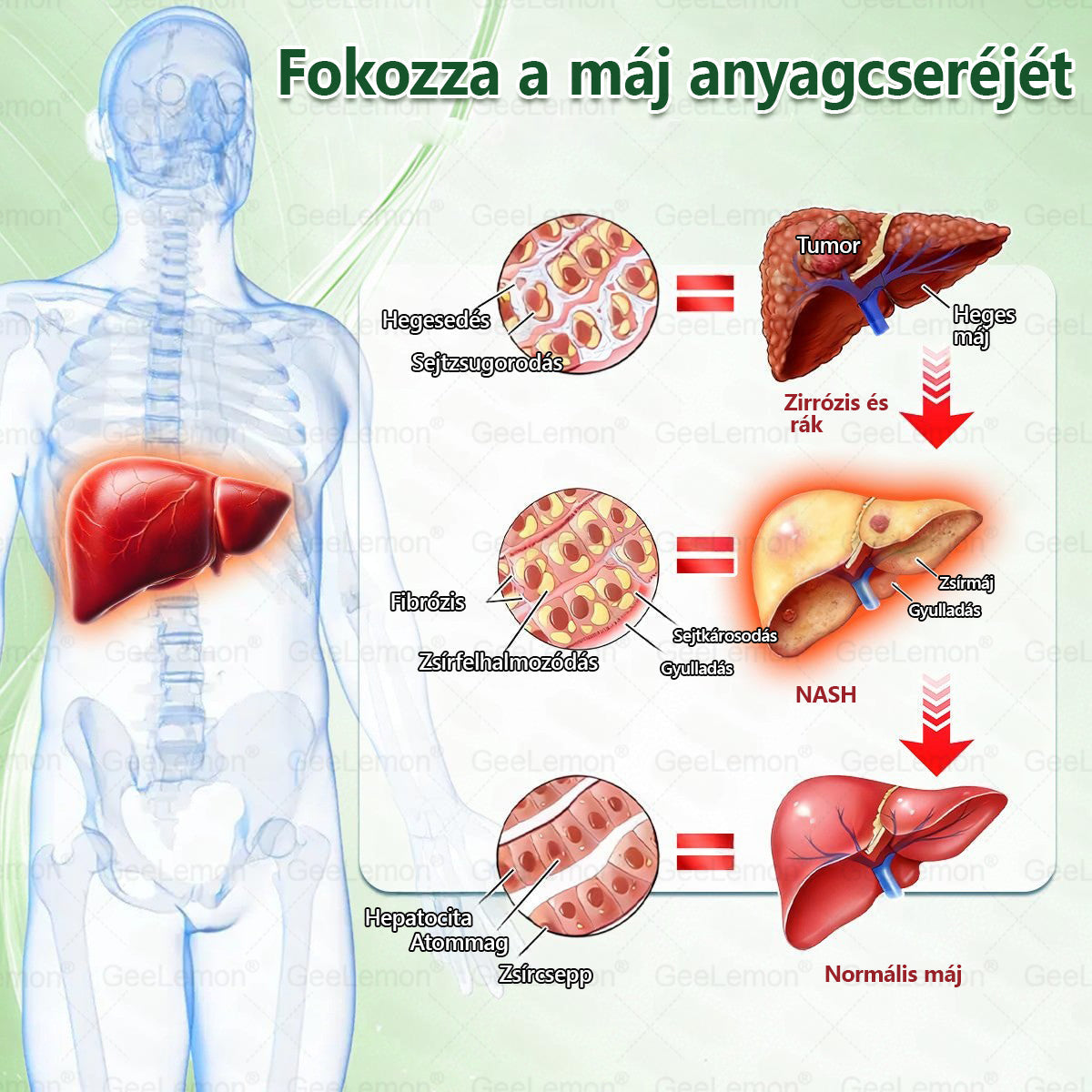 Magyar szakértők által ajánlott · 👩‍⚕️ Hivatalos márkabolt| 🎄✨ 𝐆𝐞𝑒𝐿𝑒𝐦𝐨𝐧® Glumasetide 8 az 1-ben Karcsú és Egészséges Nano Mikrotűs Tapasz 🇭🇺