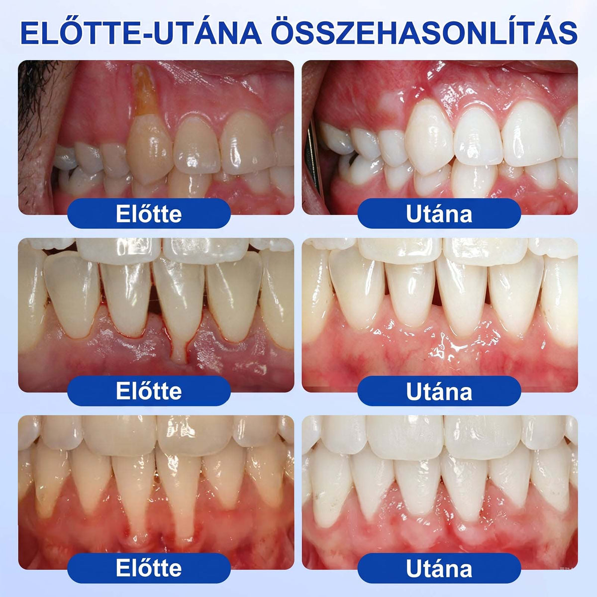 EZ AZ AJÁNLAT NEM VÁR ⏳ MOST −50% KEDVEZMÉNY 🔥 A KÉSZLET FOGY A VISSZASZÁMLÁLÁS MEGY AKI HABOZIK KÉSŐBB TÖBBET FIZET LÉPJ MOST