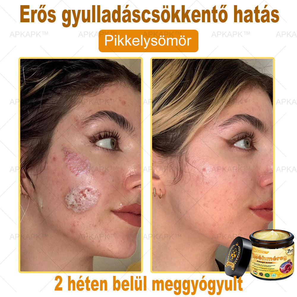 EZ AZ AJÁNLAT NEM VÁR ⏳ MOST −50% KEDVEZMÉNY 🔥 A KÉSZLET FOGY A VISSZASZÁMLÁLÁS MEGY AKI HABOZIK KÉSŐBB TÖBBET FIZET LÉPJ MOST