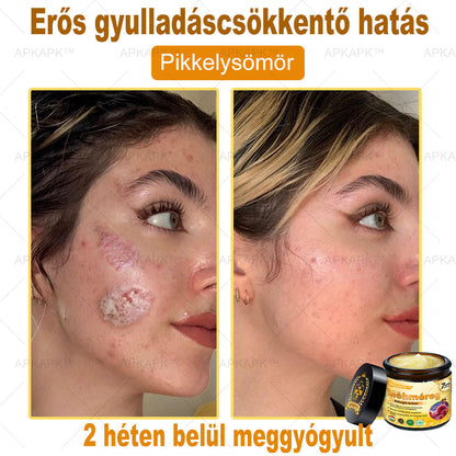 EZ AZ AJÁNLAT NEM VÁR ⏳ MOST −50% KEDVEZMÉNY 🔥 A KÉSZLET FOGY A VISSZASZÁMLÁLÁS MEGY AKI HABOZIK KÉSŐBB TÖBBET FIZET LÉPJ MOST