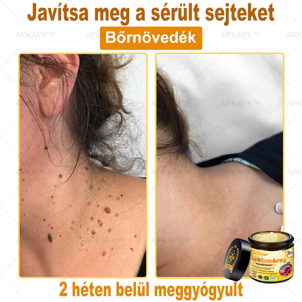 EZ AZ AJÁNLAT NEM VÁR ⏳ MOST −50% KEDVEZMÉNY 🔥 A KÉSZLET FOGY A VISSZASZÁMLÁLÁS MEGY AKI HABOZIK KÉSŐBB TÖBBET FIZET LÉPJ MOST