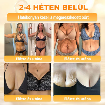 ✨ 𝖠𝖯𝖪𝖠𝖯𝖪® méhméreges bőrmegújító krém ✅ Fizetés átvételkor | ✅ Egyszeri rendelés | 🚫 Nincs havi előfizetés