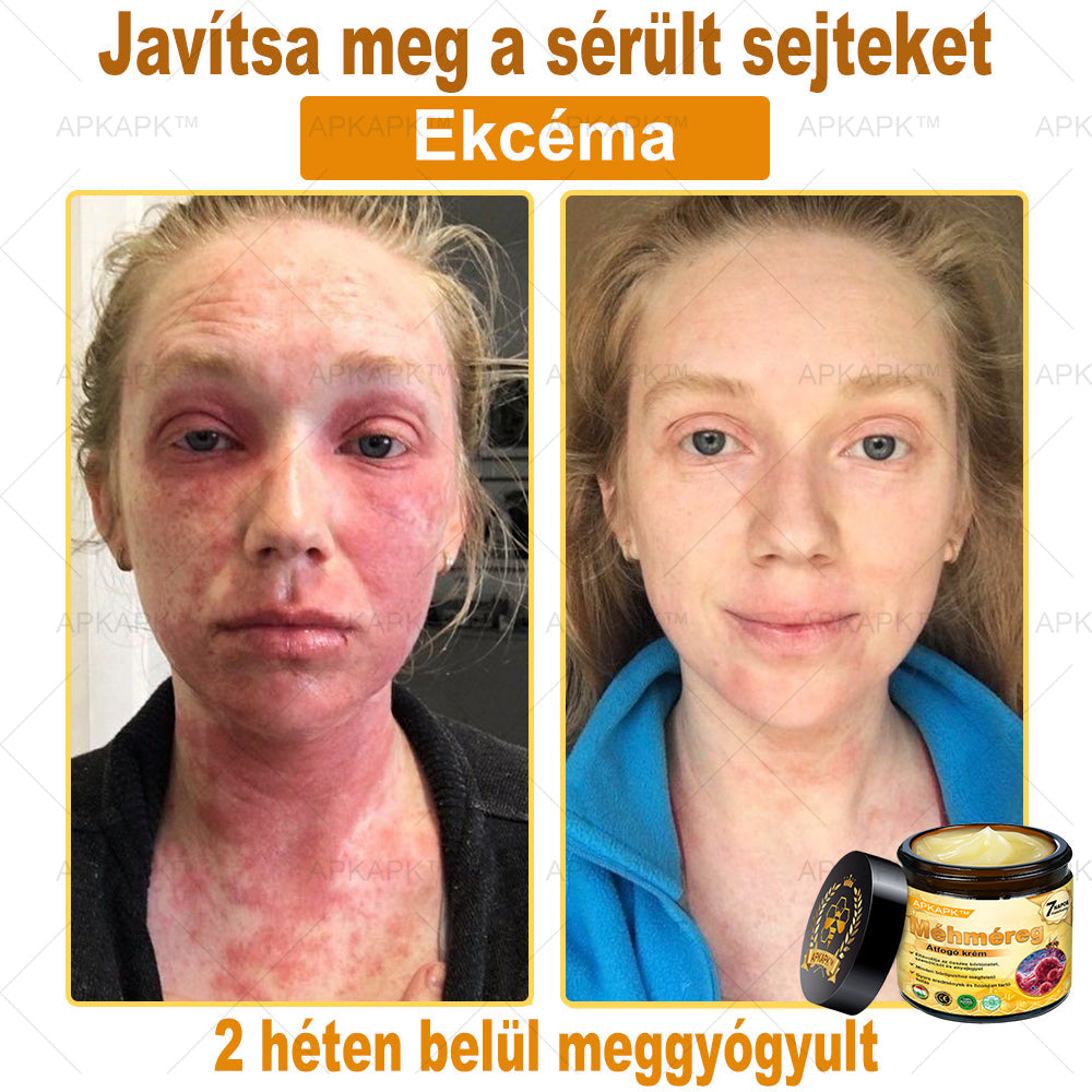 EZ AZ AJÁNLAT NEM VÁR ⏳ MOST −50% KEDVEZMÉNY 🔥 A KÉSZLET FOGY A VISSZASZÁMLÁLÁS MEGY AKI HABOZIK KÉSŐBB TÖBBET FIZET LÉPJ MOST