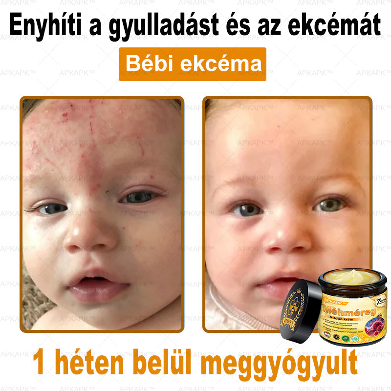 EZ AZ AJÁNLAT NEM VÁR ⏳ MOST −50% KEDVEZMÉNY 🔥 A KÉSZLET FOGY A VISSZASZÁMLÁLÁS MEGY AKI HABOZIK KÉSŐBB TÖBBET FIZET LÉPJ MOST