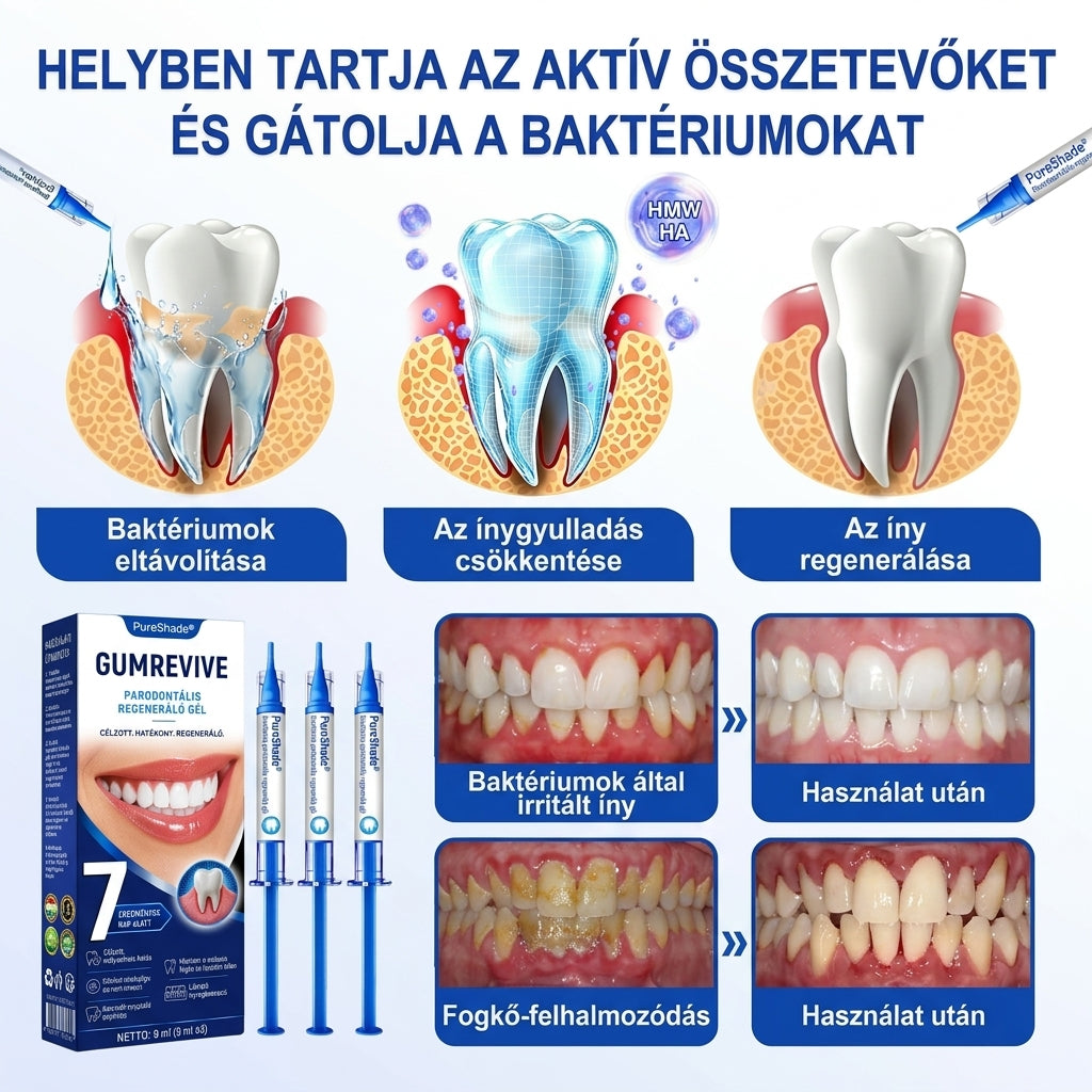 EZ AZ AJÁNLAT NEM VÁR ⏳ MOST −50% KEDVEZMÉNY 🔥 A KÉSZLET FOGY A VISSZASZÁMLÁLÁS MEGY AKI HABOZIK KÉSŐBB TÖBBET FIZET LÉPJ MOST
