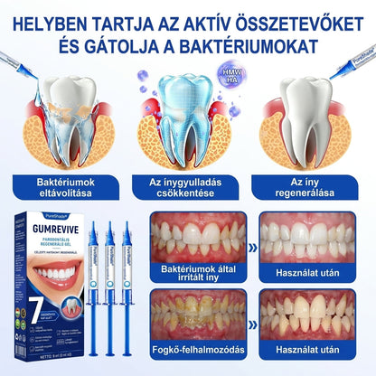 EZ AZ AJÁNLAT NEM VÁR ⏳ MOST −50% KEDVEZMÉNY 🔥 A KÉSZLET FOGY A VISSZASZÁMLÁLÁS MEGY AKI HABOZIK KÉSŐBB TÖBBET FIZET LÉPJ MOST