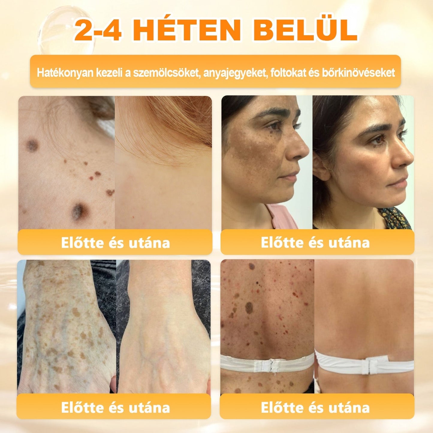 ✨ 𝖠𝖯𝖪𝖠𝖯𝖪® méhméreges bőrmegújító krém ✅ Fizetés átvételkor | ✅ Egyszeri rendelés | 🚫 Nincs havi előfizetés