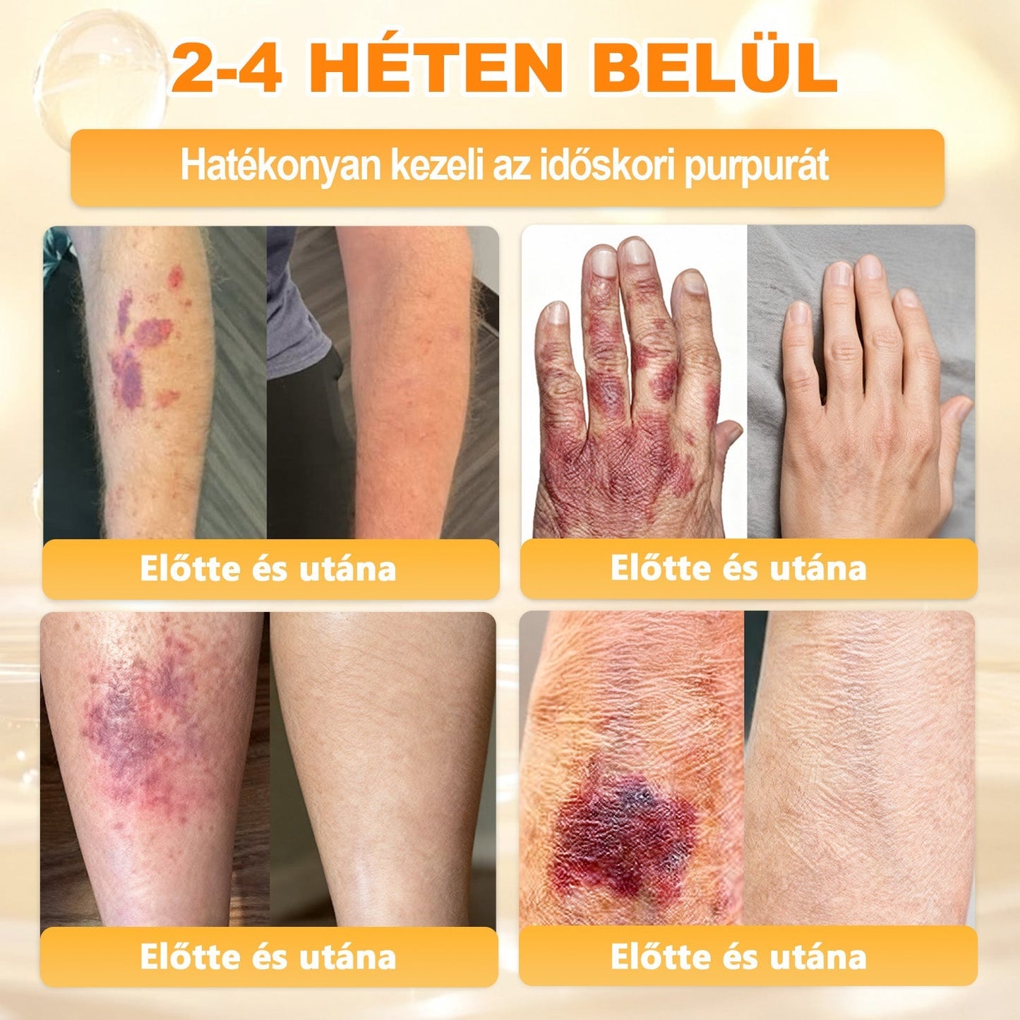 ✨ 𝖠𝖯𝖪𝖠𝖯𝖪® méhméreges bőrmegújító krém ✅ Fizetés átvételkor | ✅ Egyszeri rendelés | 🚫 Nincs havi előfizetés