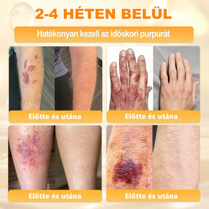 ✨ 𝖠𝖯𝖪𝖠𝖯𝖪® méhméreges bőrmegújító krém ✅ Fizetés átvételkor | ✅ Egyszeri rendelés | 🚫 Nincs havi előfizetés