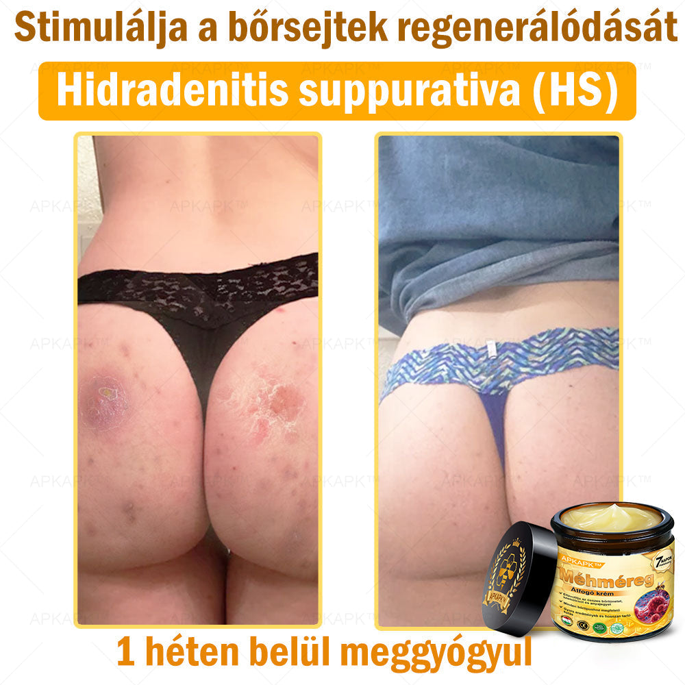 EZ AZ AJÁNLAT NEM VÁR ⏳ MOST −50% KEDVEZMÉNY 🔥 A KÉSZLET FOGY A VISSZASZÁMLÁLÁS MEGY AKI HABOZIK KÉSŐBB TÖBBET FIZET LÉPJ MOST