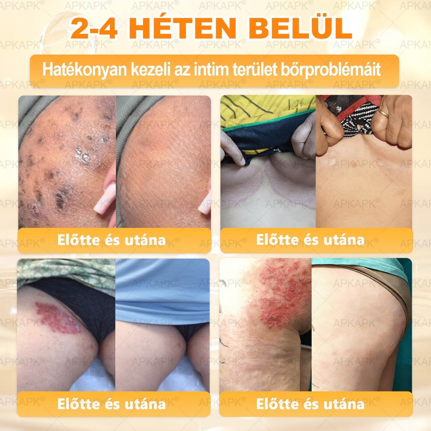 ✨ 𝖠𝖯𝖪𝖠𝖯𝖪® méhméreges bőrmegújító krém ✅ Fizetés átvételkor | ✅ Egyszeri rendelés | 🚫 Nincs havi előfizetés