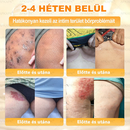 ✨ 𝖠𝖯𝖪𝖠𝖯𝖪® méhméreges bőrmegújító krém ✅ Fizetés átvételkor | ✅ Egyszeri rendelés | 🚫 Nincs havi előfizetés