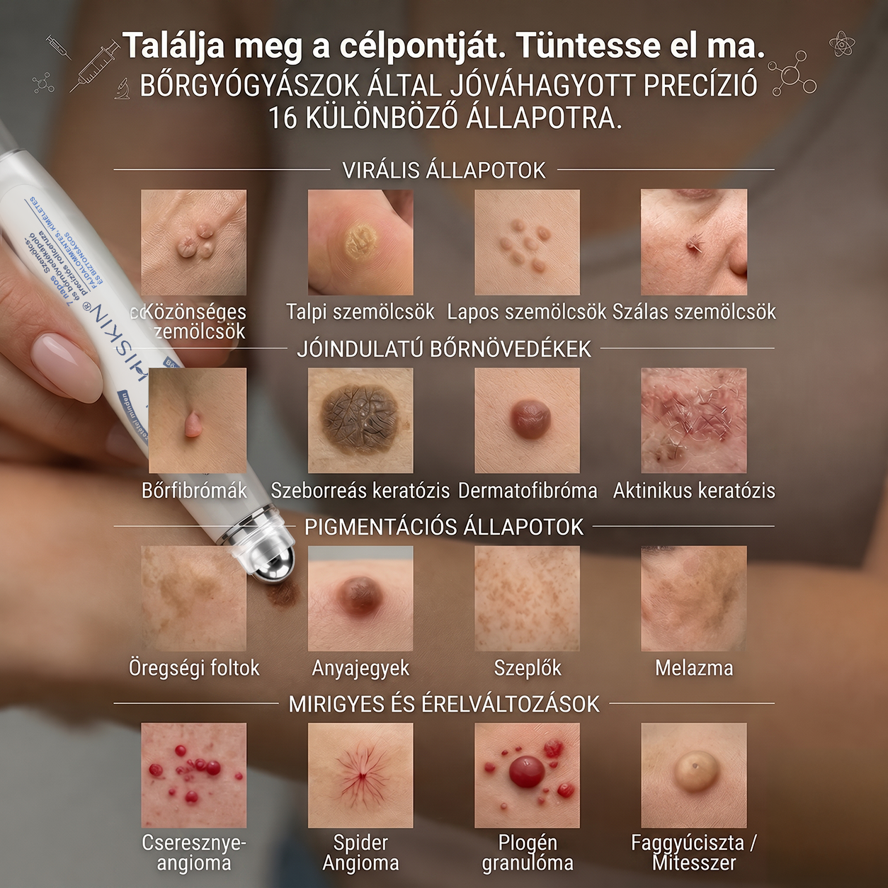 Hivatalos Márkabolt | 🚢🚢 Hiskin® 7 napos Szemölcseltávolító Roll-on Ápoló Folyadék (Fájdalommentes rollerball technológia, hegek nélkül) 🐬