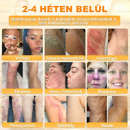 ✨ 𝖠𝖯𝖪𝖠𝖯𝖪® méhméreges bőrmegújító krém ✅ Fizetés átvételkor | ✅ Egyszeri rendelés | 🚫 Nincs havi előfizetés