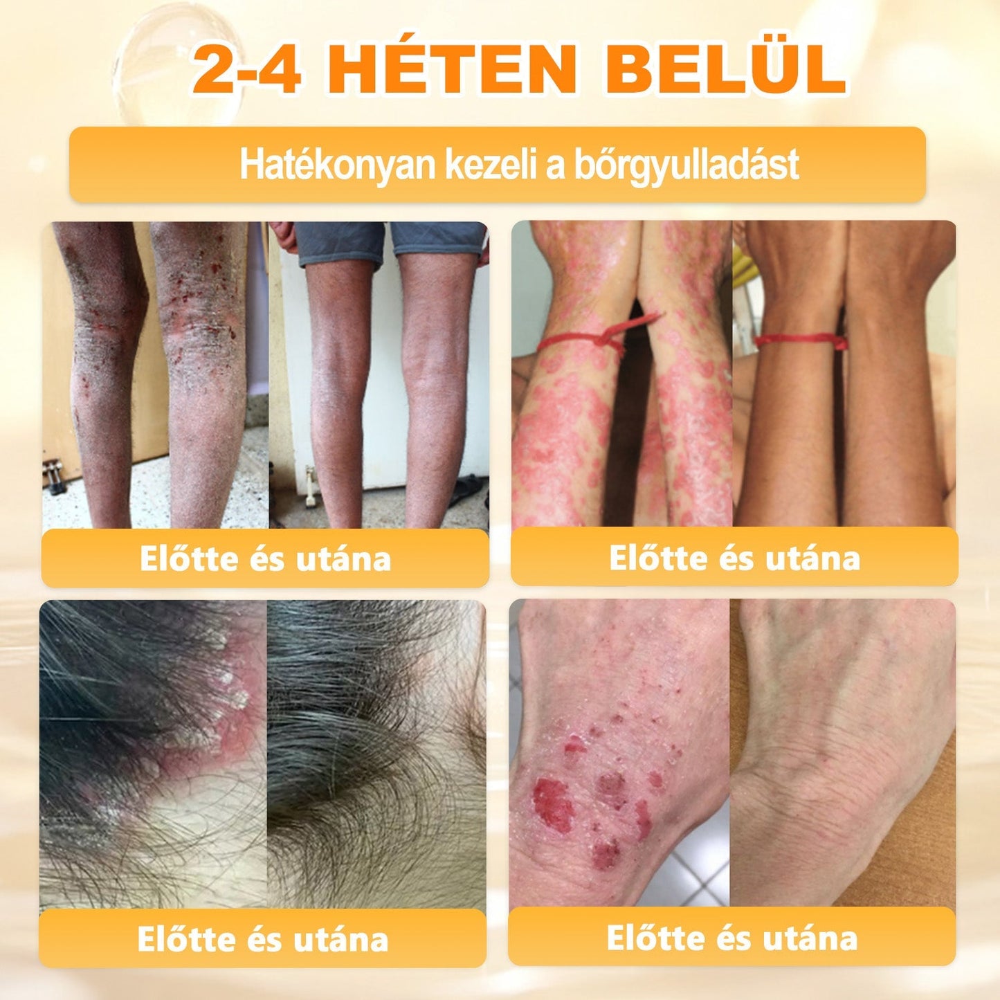 ✨ 𝖠𝖯𝖪𝖠𝖯𝖪® méhméreges bőrmegújító krém ✅ Fizetés átvételkor | ✅ Egyszeri rendelés | 🚫 Nincs havi előfizetés