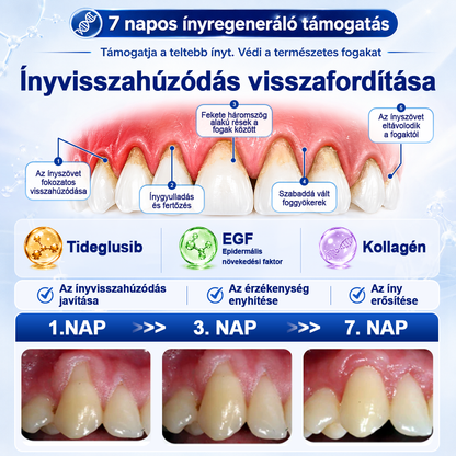 EZ AZ AJÁNLAT NEM VÁR ⏳ MOST −50% KEDVEZMÉNY 🔥 A KÉSZLET FOGY A VISSZASZÁMLÁLÁS MEGY AKI HABOZIK KÉSŐBB TÖBBET FIZET LÉPJ MOST