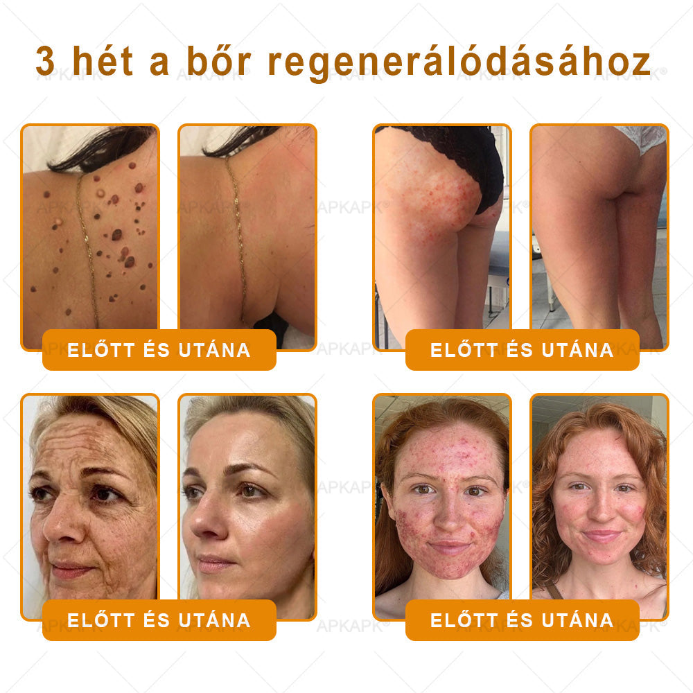 ✨ 𝖠𝖯𝖪𝖠𝖯𝖪® méhméreges bőrmegújító krém ✅ Fizetés átvételkor | ✅ Egyszeri rendelés | 🚫 Nincs havi előfizetés
