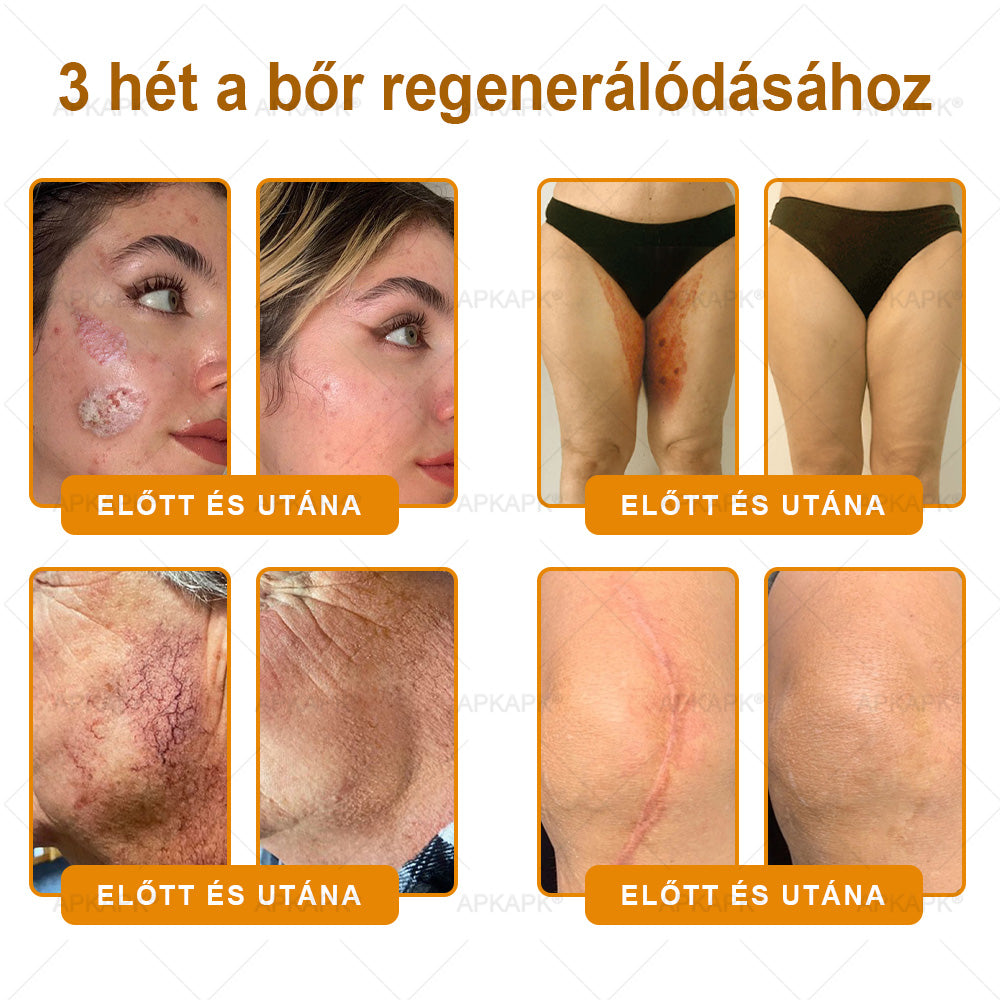 ✨ 𝖠𝖯𝖪𝖠𝖯𝖪® méhméreges bőrmegújító krém ✅ Fizetés átvételkor | ✅ Egyszeri rendelés | 🚫 Nincs havi előfizetés