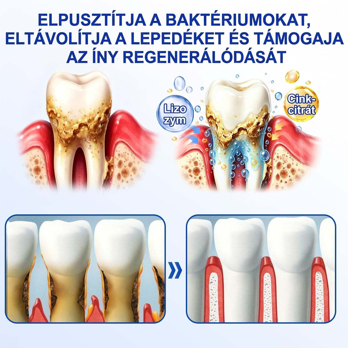 EZ AZ AJÁNLAT NEM VÁR ⏳ MOST −50% KEDVEZMÉNY 🔥 A KÉSZLET FOGY A VISSZASZÁMLÁLÁS MEGY AKI HABOZIK KÉSŐBB TÖBBET FIZET LÉPJ MOST