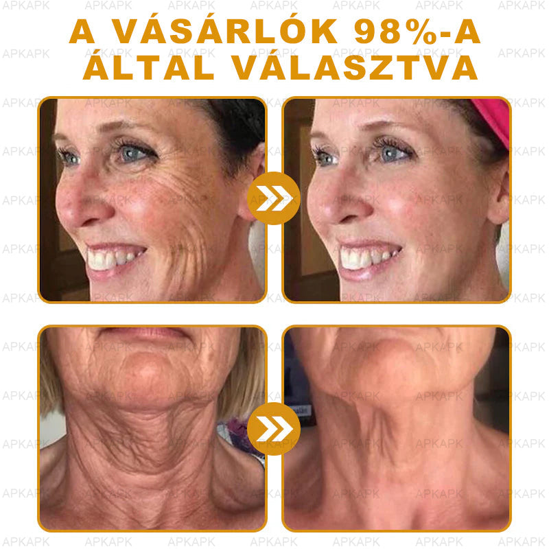 EZ AZ AJÁNLAT NEM VÁR ⏳ MOST −50% KEDVEZMÉNY 🔥 A KÉSZLET FOGY A VISSZASZÁMLÁLÁS MEGY AKI HABOZIK KÉSŐBB TÖBBET FIZET LÉPJ MOST