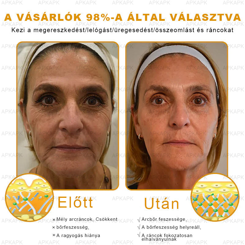 EZ AZ AJÁNLAT NEM VÁR ⏳ MOST −50% KEDVEZMÉNY 🔥 A KÉSZLET FOGY A VISSZASZÁMLÁLÁS MEGY AKI HABOZIK KÉSŐBB TÖBBET FIZET LÉPJ MOST