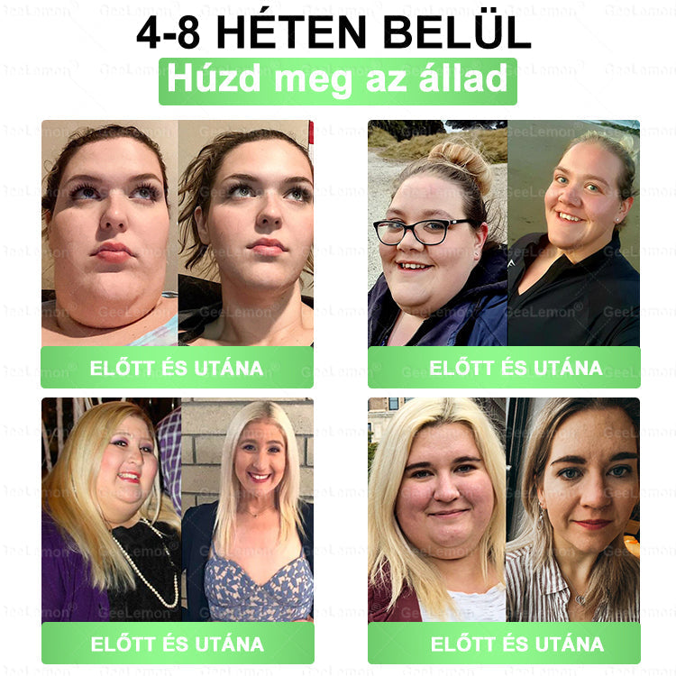 Magyar szakértők által ajánlott · 👩‍⚕️ Hivatalos márkabolt| 🎄✨ 𝐆𝐞𝑒𝐿𝑒𝐦𝐨𝐧® Glumasetide 8 az 1-ben Karcsú és Egészséges Nano Mikrotűs Tapasz 🇭🇺