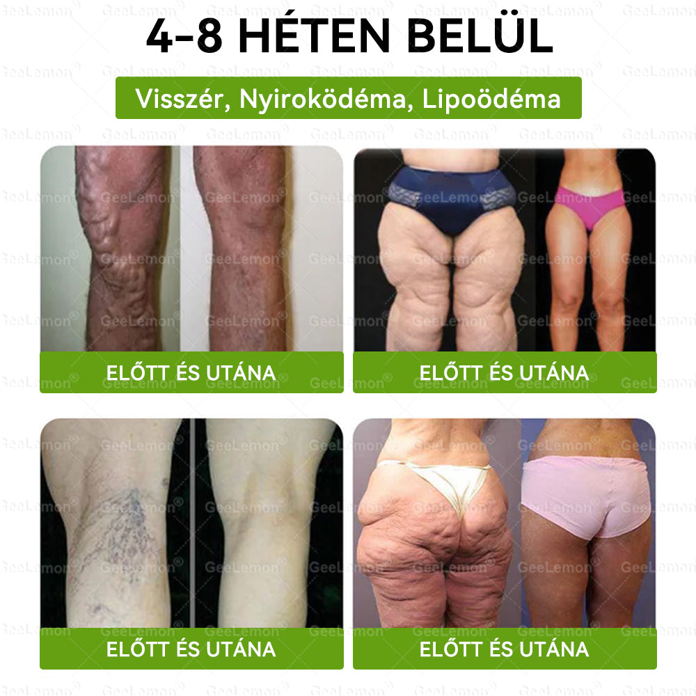 Magyar szakértők által ajánlott · 👩‍⚕️ Hivatalos márkabolt| 🎄✨ 𝐆𝐞𝑒𝐿𝑒𝐦𝐨𝐧® Glumasetide 8 az 1-ben Karcsú és Egészséges Nano Mikrotűs Tapasz 🇭🇺