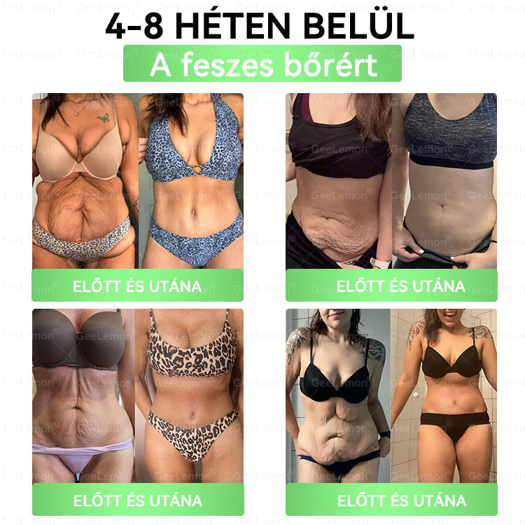 Magyar szakértők által ajánlott · 👩‍⚕️ Hivatalos márkabolt| 🎄✨ 𝐆𝐞𝑒𝐿𝑒𝐦𝐨𝐧® Glumasetide 8 az 1-ben Karcsú és Egészséges Nano Mikrotűs Tapasz 🇭🇺